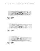 EXPANDABLE TIP ASSEMBLY FOR THROMBUS MANAGEMENT diagram and image