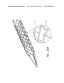 EXPANDABLE TIP ASSEMBLY FOR THROMBUS MANAGEMENT diagram and image