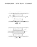 EXPANDABLE TIP ASSEMBLY FOR THROMBUS MANAGEMENT diagram and image