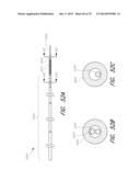 EXPANDABLE TIP ASSEMBLY FOR THROMBUS MANAGEMENT diagram and image