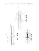 EXPANDABLE TIP ASSEMBLY FOR THROMBUS MANAGEMENT diagram and image