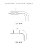 EXPANDABLE TIP ASSEMBLY FOR THROMBUS MANAGEMENT diagram and image