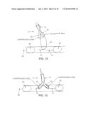 METHOD AND APPARATUS FOR EFFECTING AN AORTIC VALVE BYPASS, INCLUDING THE     PROVISION AND USE OF A T-STENT FOR EFFECTING A DISTAL ANASTOMOSIS FOR THE     SAME diagram and image