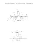 METHOD AND APPARATUS FOR EFFECTING AN AORTIC VALVE BYPASS, INCLUDING THE     PROVISION AND USE OF A T-STENT FOR EFFECTING A DISTAL ANASTOMOSIS FOR THE     SAME diagram and image