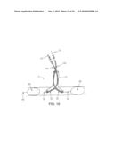 METHOD AND APPARATUS FOR EFFECTING AN AORTIC VALVE BYPASS, INCLUDING THE     PROVISION AND USE OF A T-STENT FOR EFFECTING A DISTAL ANASTOMOSIS FOR THE     SAME diagram and image