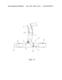 METHOD AND APPARATUS FOR EFFECTING AN AORTIC VALVE BYPASS, INCLUDING THE     PROVISION AND USE OF A T-STENT FOR EFFECTING A DISTAL ANASTOMOSIS FOR THE     SAME diagram and image