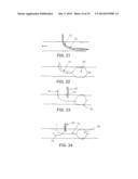 METHOD AND APPARATUS FOR EFFECTING AN AORTIC VALVE BYPASS, INCLUDING THE     PROVISION AND USE OF A T-STENT FOR EFFECTING A DISTAL ANASTOMOSIS FOR THE     SAME diagram and image