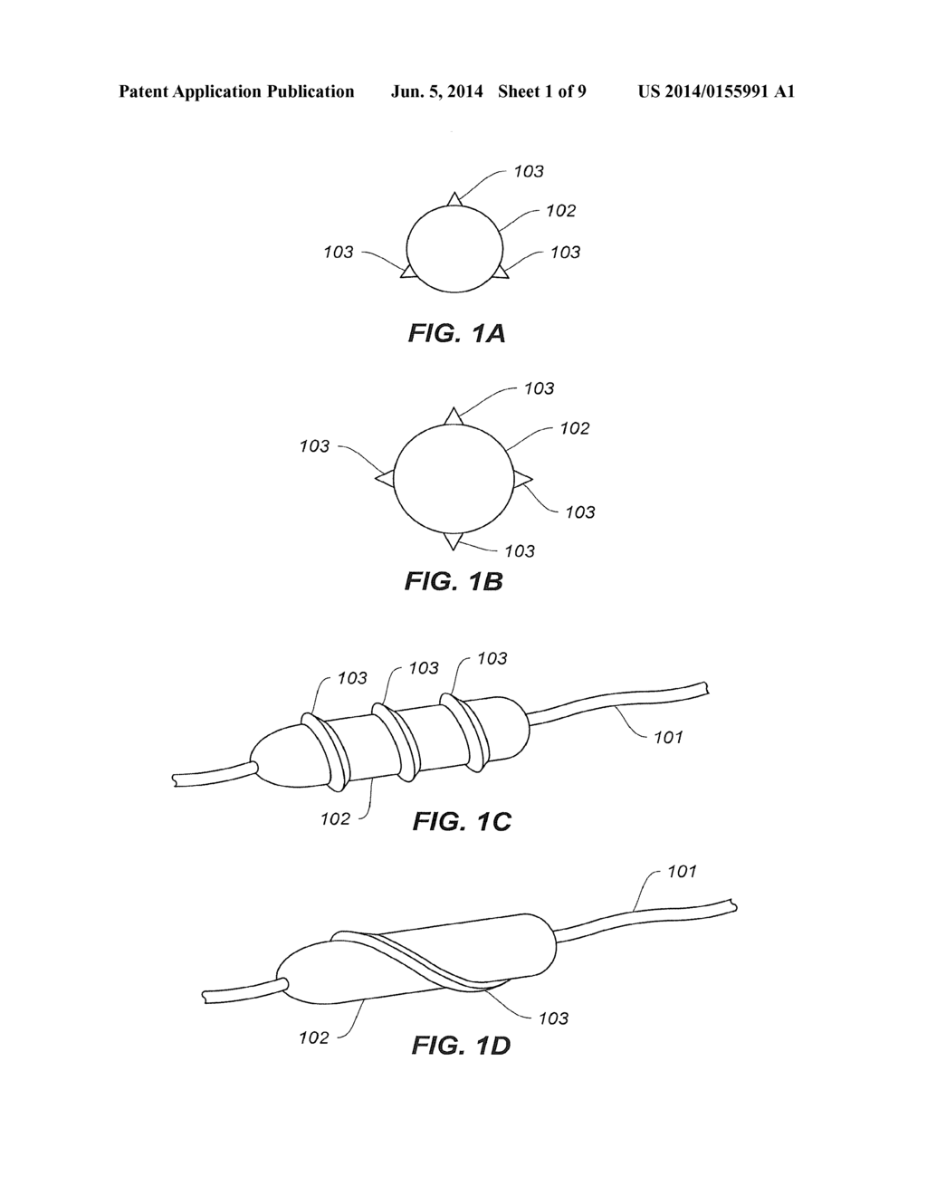 PROSTHETIC VALVE IMPLANT SITE PREPARATION TECHNIQUES - diagram, schematic, and image 02