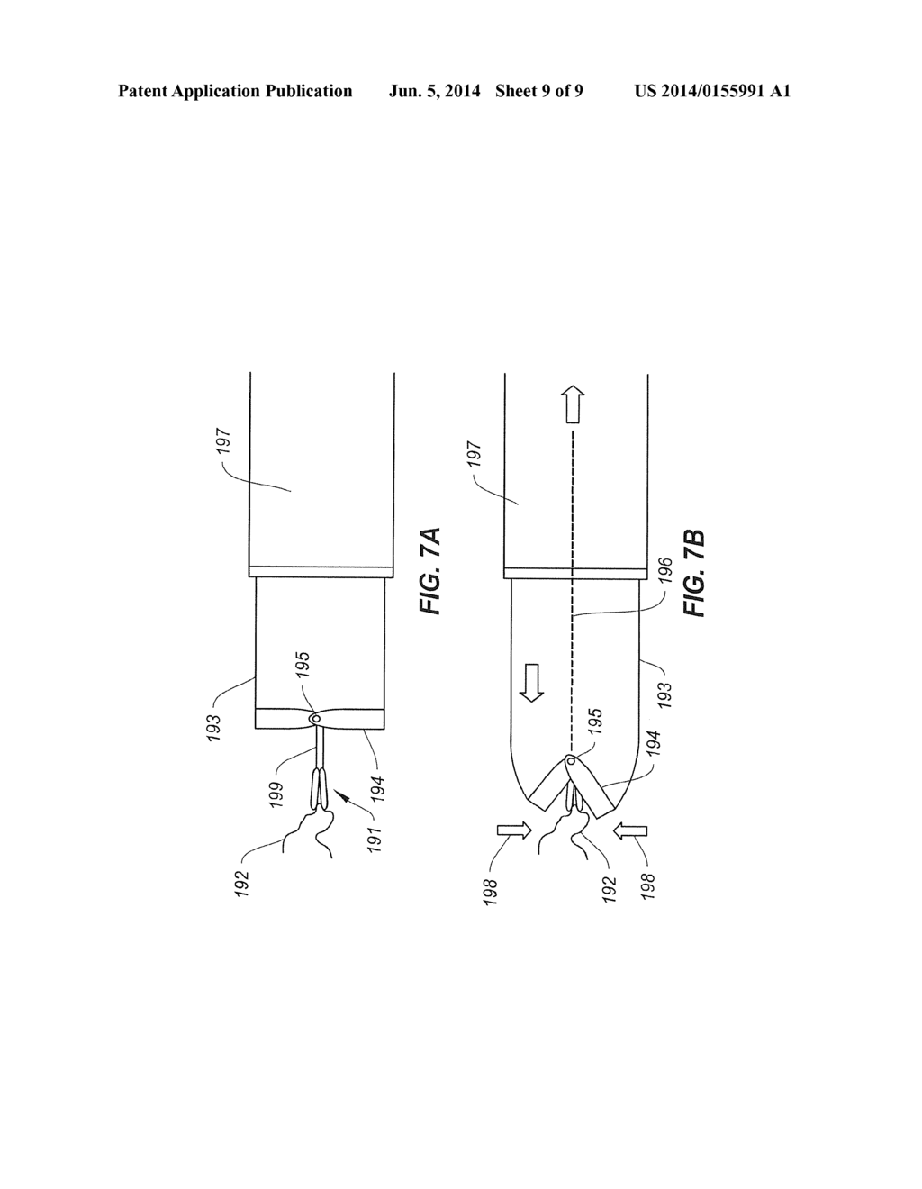 PROSTHETIC VALVE IMPLANT SITE PREPARATION TECHNIQUES - diagram, schematic, and image 10