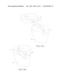 FLEX ANCHOR FOR ATTACHING A PROSTHESIS TO BONE diagram and image