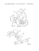 PROSTHESIS AND IMPLEMENTATION SYSTEM diagram and image