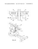 PROSTHESIS AND IMPLEMENTATION SYSTEM diagram and image