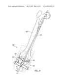 PROSTHESIS AND IMPLEMENTATION SYSTEM diagram and image