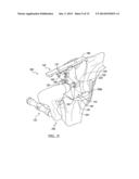 PROSTHESIS AND IMPLEMENTATION SYSTEM diagram and image