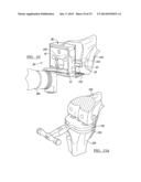 PROSTHESIS AND IMPLEMENTATION SYSTEM diagram and image