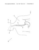 STENT SYSTEM AND METHODS OF USE diagram and image