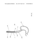 STENT SYSTEM AND METHODS OF USE diagram and image