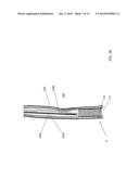 STENT SYSTEM AND METHODS OF USE diagram and image