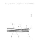 STENT SYSTEM AND METHODS OF USE diagram and image