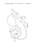 MOLDED WRISTBAND CASE diagram and image