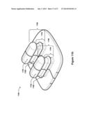 MOLDED WRISTBAND CASE diagram and image