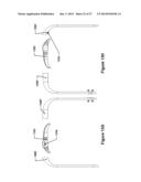 MOLDED WRISTBAND CASE diagram and image