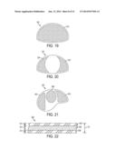 HEAD GUARD diagram and image