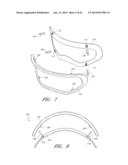 EYEWEAR WITH OUTRIGGERS diagram and image