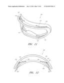 EYEWEAR WITH OUTRIGGERS diagram and image