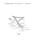 Hydro-Therapeutic Jet Massage Device diagram and image