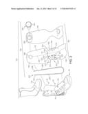 Article With Adjustable Stiffness Tongue diagram and image