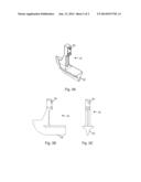 Control Joint Device diagram and image