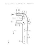 NASAL CANNULA FOR DELIVERY OF AEROSOLIZED MEDICAMENTS diagram and image