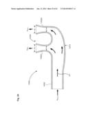 NASAL CANNULA FOR DELIVERY OF AEROSOLIZED MEDICAMENTS diagram and image