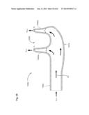 NASAL CANNULA FOR DELIVERY OF AEROSOLIZED MEDICAMENTS diagram and image