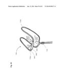 NASAL CANNULA FOR DELIVERY OF AEROSOLIZED MEDICAMENTS diagram and image