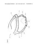 NASAL CANNULA FOR DELIVERY OF AEROSOLIZED MEDICAMENTS diagram and image