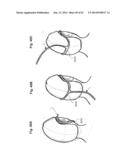 NASAL CANNULA FOR DELIVERY OF AEROSOLIZED MEDICAMENTS diagram and image