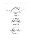 TEXTILE MASK SYSTEMS diagram and image