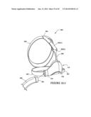 TEXTILE MASK SYSTEMS diagram and image