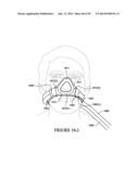 TEXTILE MASK SYSTEMS diagram and image