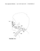 TEXTILE MASK SYSTEMS diagram and image