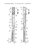 Surgical Stapler diagram and image