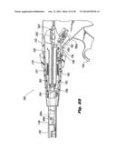 Surgical Stapler diagram and image