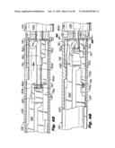 Surgical Stapler diagram and image