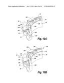 SELF ALIGNING SPLIT MECHANICAL SEAL EMPLOYING A SELECTIVELY ENGAGEABLE     AXIAL BIASING ASSEMBLY diagram and image