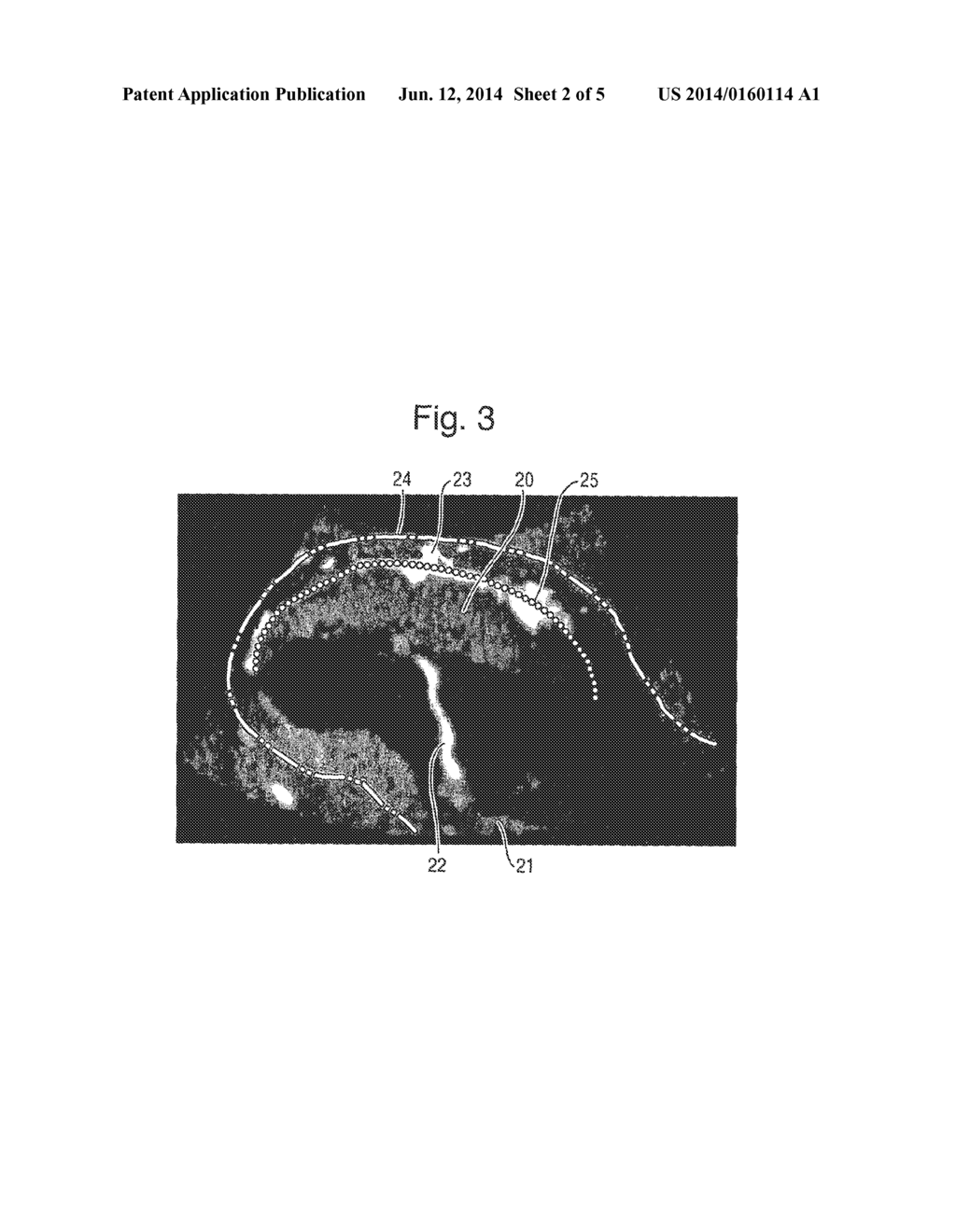 Transformation of a Three-Dimensional Flow Image - diagram, schematic, and image 03