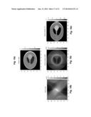 IMAGE RECONSTRUCTION FROM LIMITED OR INCOMPLETE DATA diagram and image