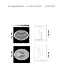 IMAGE RECONSTRUCTION FROM LIMITED OR INCOMPLETE DATA diagram and image