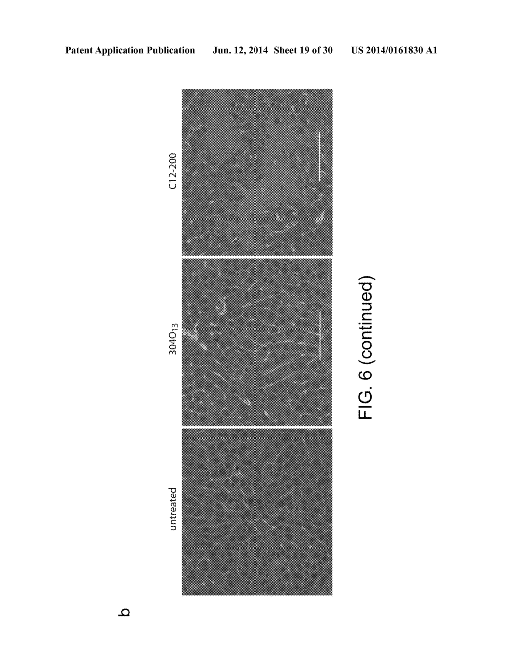 AMINE-CONTAINING LIPIDOIDS AND USES THEREOF - diagram, schematic, and image 20